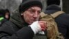 Жители Киева показывают последствия удара России по городу: "Посекло хорошо: от пояса до низа, руки"