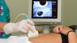 Феминистка Леда Гарина – о штрафе за "склонение к аборту" в России