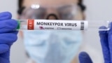 Первый россиянин, заразившийся оспой обезьян, выписан из больницы. Что известно о заболевании