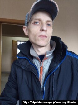 Андрей Ципуховский с синяками после избиения в психиатрической лечебнице