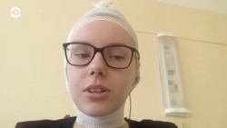 Рассказ 19-летней Марии Зайцевой, пострадавшей от взрыва шумовой гранаты в Минске