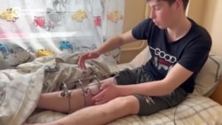 "Лежишь и думаешь: "Боже, за что тебе это?" Истории подростков из Луганской области, раненных во время российских обстрелов
