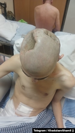 Магомедбек Хизбулаев в госпитале