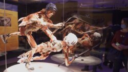 Do Ice-Skating Corpses Insult 'Religious Feelings'? Russia Investigates Body Worlds