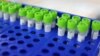 Malibu, California, U.S. - PCR coronavirus tests are seen at a testing site, as the global outbreak of the coronavirus disease (COVID-19) continues