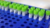 Malibu, California, U.S. - PCR coronavirus tests are seen at a testing site, as the global outbreak of the coronavirus disease (COVID-19) continues