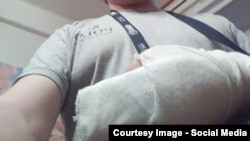 Сломанные пальцы сотрудника "Вконтакте": нападавшие целенаправленно били его по руке
