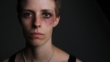 Год семейного насилия в России. Истории женщин, которых избили мужья или партнеры