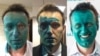Навальному прооперировали глаз в клинике Барселоны