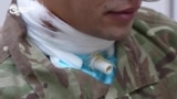 История украинского военного, пережившего пытки в российском плену