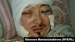 Кадыр Маликов после нападения в больнице
