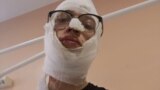 Максим Кокорин, обожженный в машине полиции подросток из Иркутска