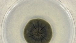 Cladosporium sphaerospermum – тот самый чернобыльский грибок – в чашке петри