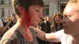 Moscow Protests Parushina Injured GRAB