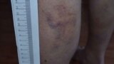 surgut jehova`s witnesses torture