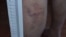 surgut jehova`s witnesses torture