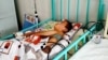 В Узбекистане 11-летний мальчик впал в кому после того, как его избил тренер