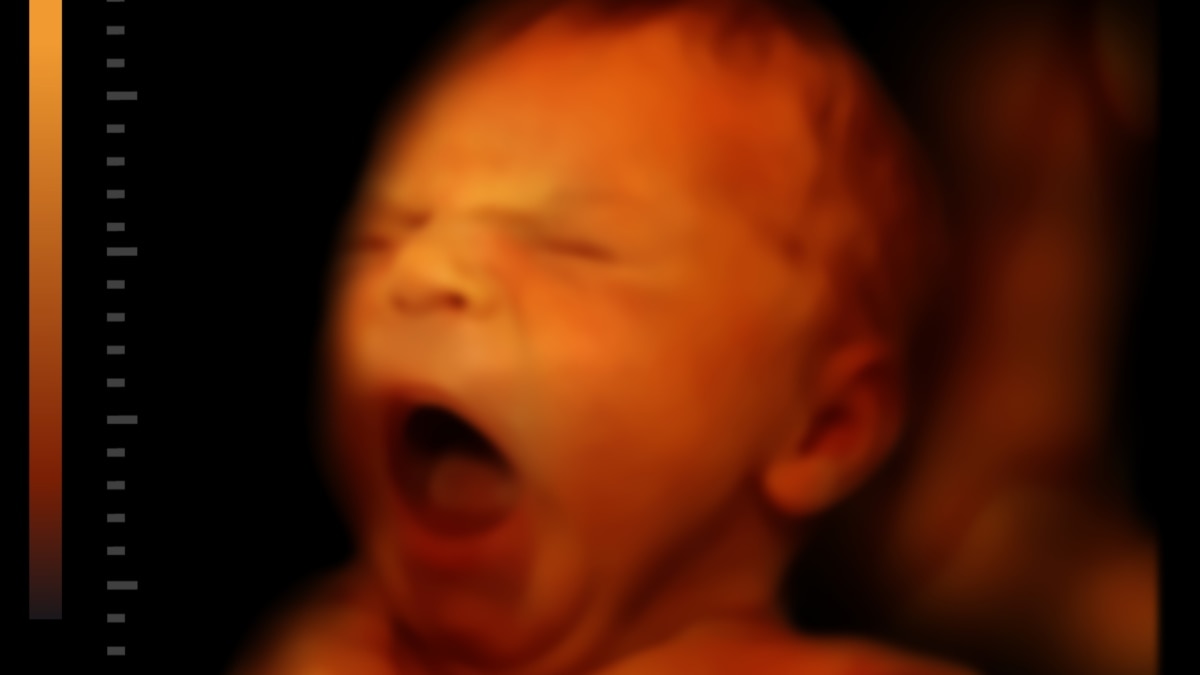 Снимок лица ребенка в утробе матери
