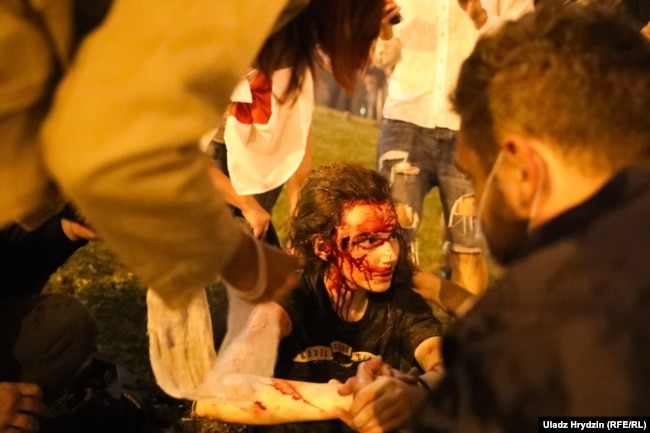 Раненая девушка во время протестов в Минске в ночь на 10 августа 2020 года. Фото: RFE/RL