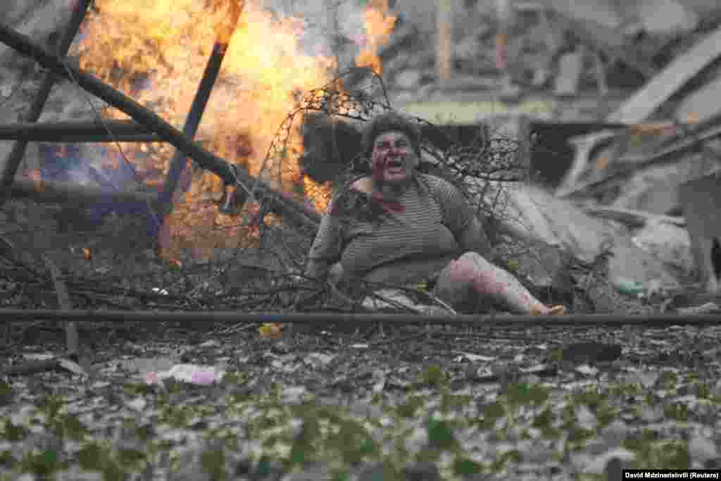 Раненая женщина в городе Гори, 80 километров от Тбилиси. 9 августа 2008