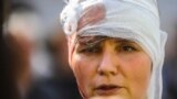 Мунициальный депутат рассказывает, как силовики ей разбили голову на Тверской