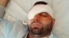 Москвич, который стрелял в метро в гражданина Таджикистана и выбил ему глаз, приговорен к 10 годам тюрьмы