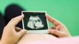 "Поправка о запрете абортов сейчас не пройдет через Госдуму" - священник о предложении запретить аборты в РФ