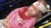 Родители рассказали, как в Гродно по вине силовиков была ранена 5-летняя девочка