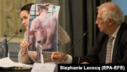 Светлана Тихановская демонстрирует в Брюсселе фотографию человека, избитого силовиками в Беларуси. Сентябрь 2020 года