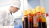 ВИЧ-положительные люди в Кыргызстане не афишируют свой статус, каждый третий – отказывается от лечения 