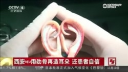 Китайские медики вырастили ухо для пересадки у пациента на руке