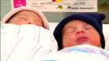 В США близнецы родились с разрывом в год