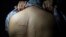 UKRAINE -- In this photo taken on Wednesday, Oct. 9, 2019, Bogdan Sergiets, former resident of Donetsk, shows a swastika scar on his back in a photographer's studio in Kyiv, Ukraine. 