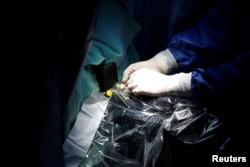 Операция по удалению опухоли в медицинском центре Ramat Aviv в Тель-Авиве, Израиль. Фото: Reuters