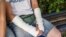 Belarus - Hrodna.Life journalist Ruslan Kulevich that was detainted during the protests. Riot police brohe his arm. Hrodna, 2Sep2020